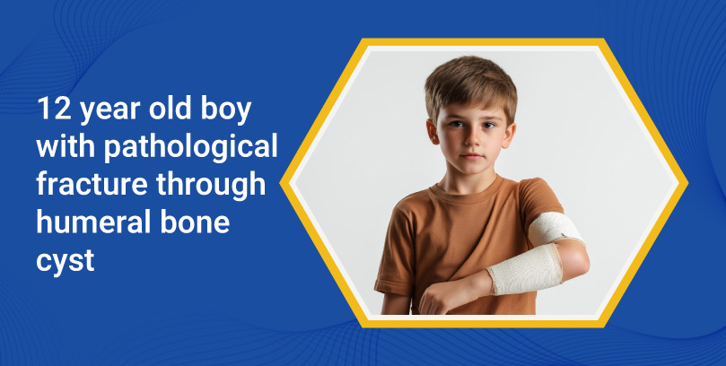 12-Year-Old Boy With Pathological Fracture Through A Humeral Bone Cyst
