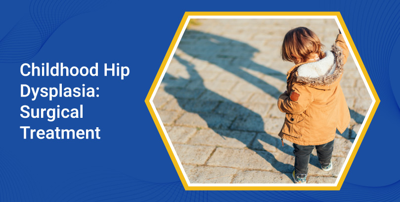 Childhood Hip Dysplasia: Surgical Treatment