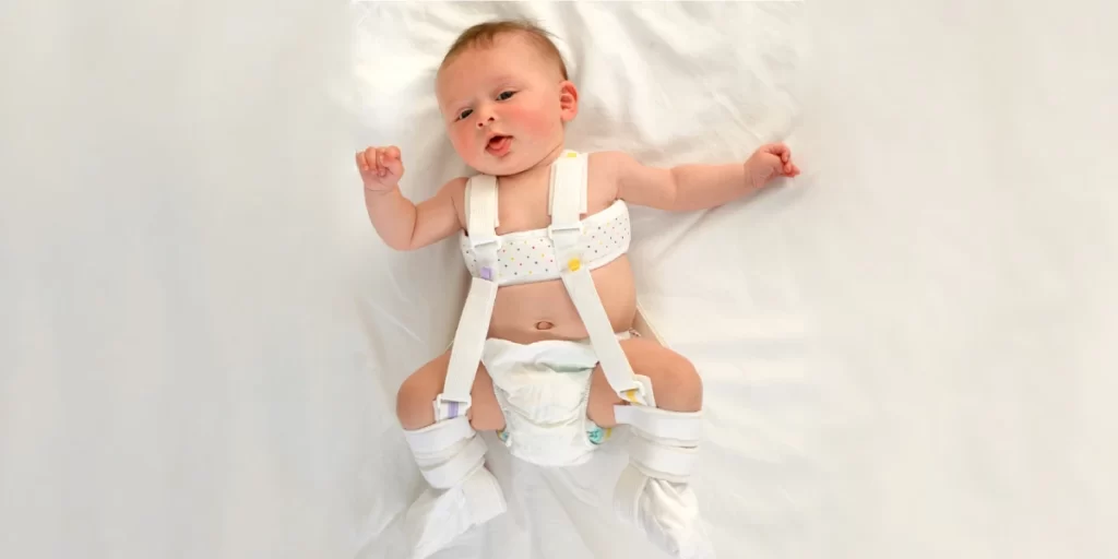 Developmental-Hip-Dysplasia Early Diagnosis