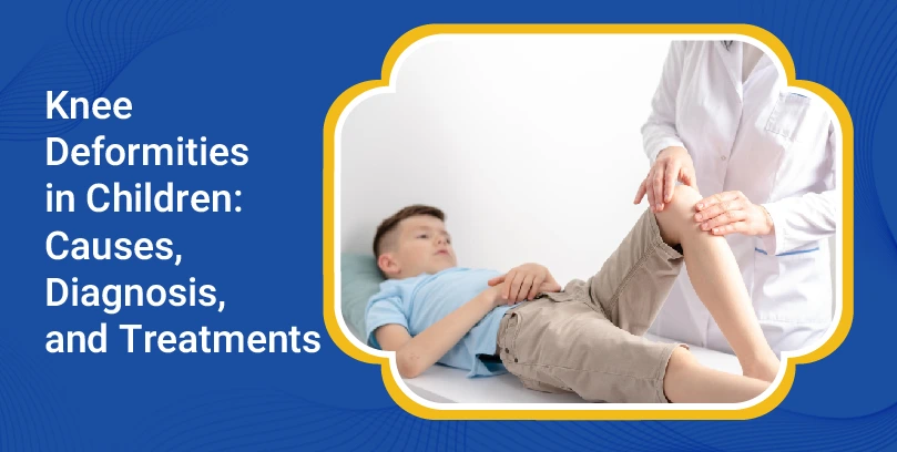 Knee Deformities in Children: Causes, Diagnosis, and Treatments